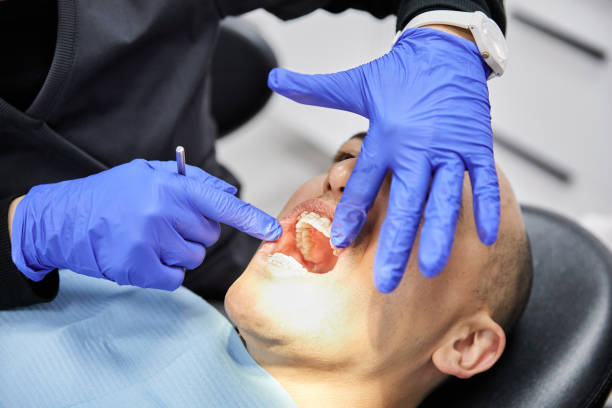 Best Knocked-Out Tooth (Avulsed Tooth) Treatment in Marshall, VA