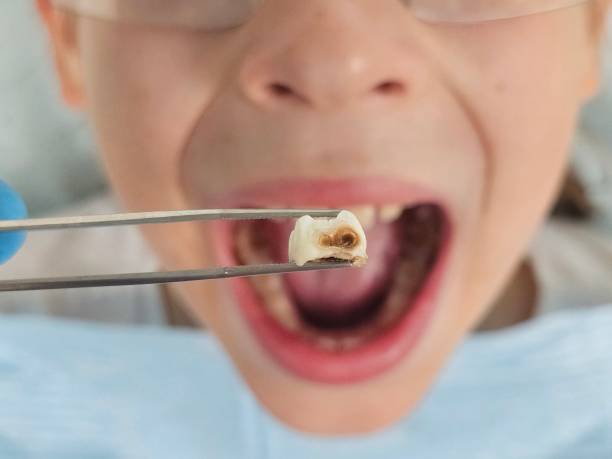 Best Emergency Cosmetic Dentistry (e.g., broken veneers) in Marshall, VA